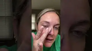 Dr Melaxin peel shot literally removes anything! #peelshot #drmelaxin #dealsforyoudays
