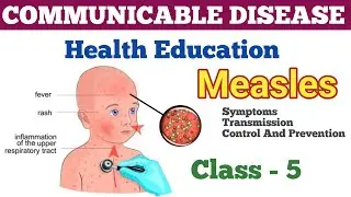 Measles // Communicable Disease / Symptoms and prevention / Health Education #pharmacist#findyourjob
