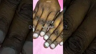 Dark Knuckles? Do This Every Night #shorts #888 #darkknuckles #beauty #kpop #youtubeshorts #selfcare