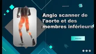 CT Scanner -Angio scanner de l'aorte et des membres inf&eacute;rieurs Partage de pratiques