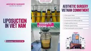 ADVANCED LIPOSUCTION TECHNOLOGY &ndash; SLIM BODY, FAST