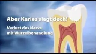 Laserbohren