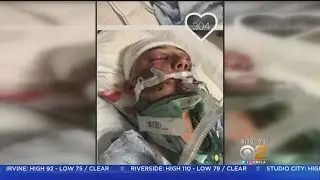 Man Arrested In Vicious Beating Of San Pedro Teen
