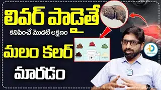 మీ మలం కలర్ మారితే  | Motion Colour Change Most Unique Sign Of Liver Damage | iD Post Health