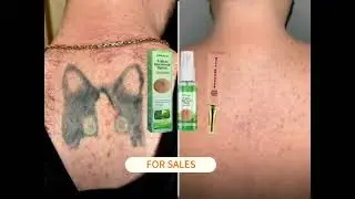 tattoo removal cream without any scars in Short time