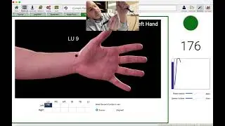 How to use AcuGraph to Get tons of new patients.