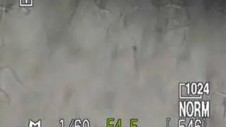 Microfilaria