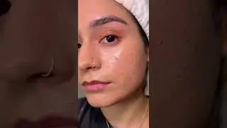 FENTY SOFT LIT FOUNDATION ON ACNE / TEXTURED SKIN #acne #makeup #texturedskin