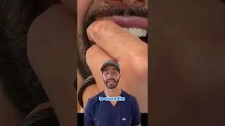 Invisalign cleaning technique that works best for me.