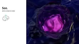 ZEISS Tumor Workflow - Reconsider the standard of care
