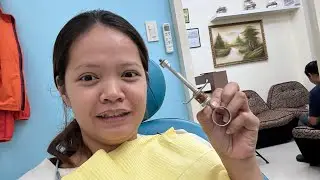 SOBRANG SAKIT WISDOM TOOTH JOURNEY ANG MAHAL 😱😱