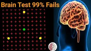 Brain & Eyes Test | illusion Test Your Brain |  Motion-induced Blindness |#quizmastertnl