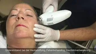 Mezotix® (Tixel-Technologie) - Premiumbehandlung - unser Ziel Hautstraffung + Hautbildverbesserung