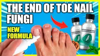 What is Kerassentials - Antifungal Toenail Treatment Antifungal Solution - Reviews 2023