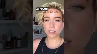 How to conceal melasma #makeuptutorial #concealer #melasma #hyperpigmentation