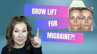 Brow Lift for Migraine - any Evidence?!
