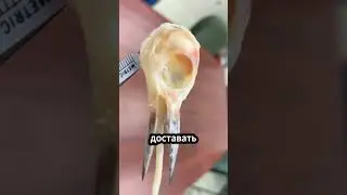 Почему у дятлов не сотрясается мозг? 🐦🌳