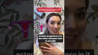 Can you get pregnant with one fallopian tube? #youtubeshorts #gynaecology