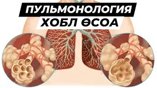 ХОБЛ / Этиолоия / Патогенез / Өкпенің созылмалы обструкциялық ауруы