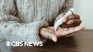 How to protect your skin from wildfire smoke and air pollution