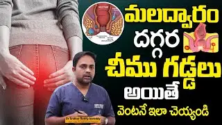 మలద్వారం దగ్గర చీము, పుండ్లు | Causes of Perianal Abscess In Telugu | Dr. SRIDHAR REDDY | SumanTv