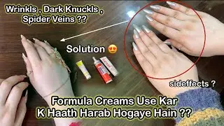 My Skincare Routine in Winters | Remove dark knuckls Wrinkls & spider veins | whitening Cream,lotion