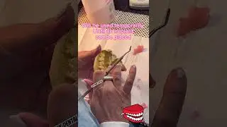 Making a flipper tooth 🦷 #shorts