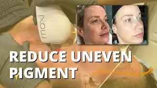MUST HAVE MOXI FOR HOLLYWOOD GLOWING SKIN | Dr. Jason Emer