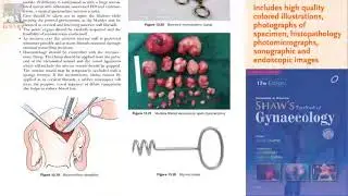 Howkins & Bourne Shaw's Textbook of Gynaecology, 17th Edition