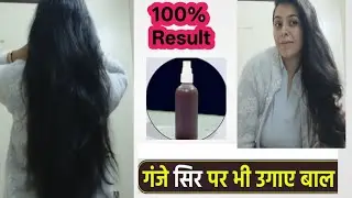 Reverse Baldness Naturally with this herbal Hair Oil Remedy at Home  | Hair Regrowth toner in 10days