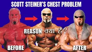 HINDI - Why Scott Steiner Has Gap Between His Chest???