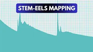 FEI Themis Z S/TEM + Gatan Continuum ER energy filter: STEM-EELS mapping