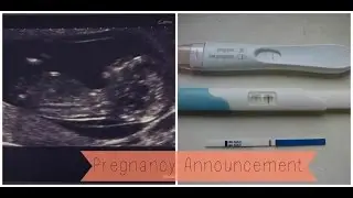 Pregnancy Announcement! | JVCxo