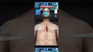 Open heart surgery doctor 3D game new game Android gaming Boss