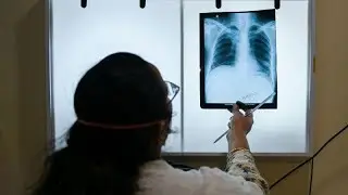 India's TB Elimination Fight: Why It's Failing Despite Govt Plans