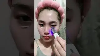 ANLAN EMS Eye Beauty Device Microcurrent Eye Massager Remove Eye Bags Dark Circles