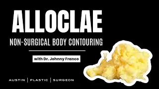 AlloClae: The Hottest Body Contouring Trend of 2025 | Uses, Benefits & Real Results