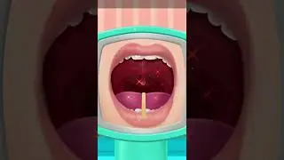 asmr tonsils removal animation #asmr #tonsils #asmranimation #asmrvideo #youtubeshorts #trending