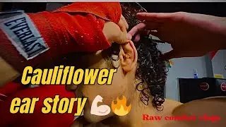 Cauliflower Ear Story 🤕🔥 Raw combat vlogs 