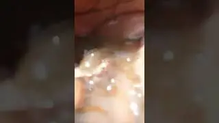 Wow! Amazing fisherman caught betta fish by hand #short