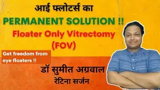 आई फ्लोटर्स से पायें छुटकारा l Floater Only Vitrectomy (FOV) for permanent treatment of eye floaters