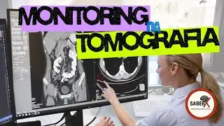 MONITORING - SOMATON GO NOW - Siemens