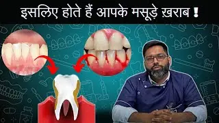 इसलिए होते हैं आपके मसूड़े ख़राब! | Solution for Gum Problems #gumhealth #dentistry