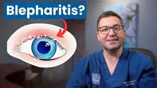 Easy Home Remedies for Blepharitis & MGD Relief