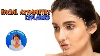The 6 Habits Making Your Face Uneven & How To FIX It | Facial Asymmetry Explained