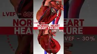 NORMAL HEART vs HEART FAILURE #shorts #heartanimation #cardiology #anatomy #hearthealth