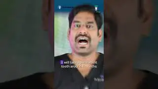 நிரந்தர பல் எப்போ தான் வரும் - When will the permanent teeth come out | Dr.Karthikeyan | Denta Kings