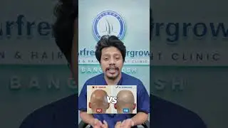 . FUE VS  FUT.NORMAL FUE HAIR TRANSPLANT surgery. lowest cost hair transplant surgery. hair care.