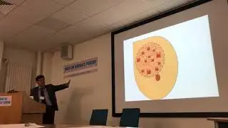 Rethinking Neoadjuvant Chemotherapy for breast cancer - Prof Jayant Vaidya, Indo-UK Breast Forum