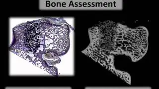 Case Study 2 - Correlation of Micro-CT and Histomorphometry Data